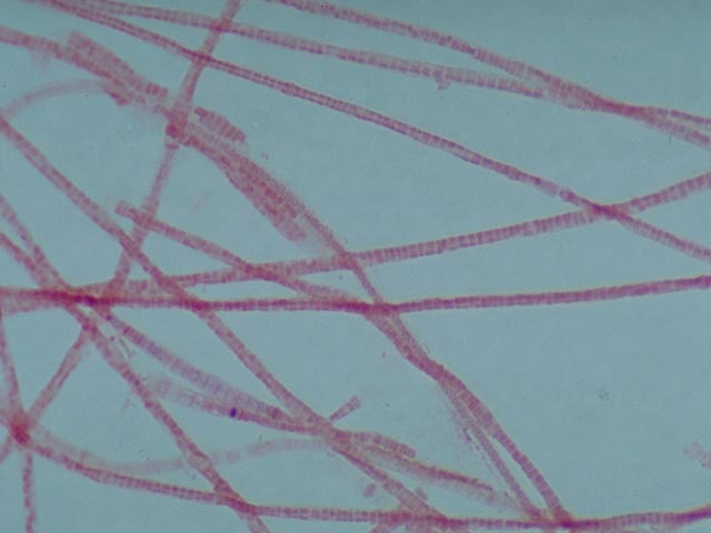Gram negative