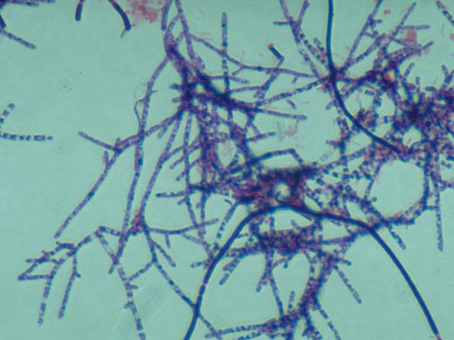 Gram positive